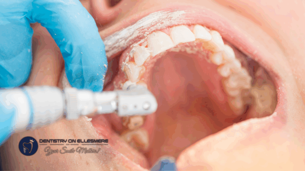 The Difference Between Dental Cleaning Types Explained