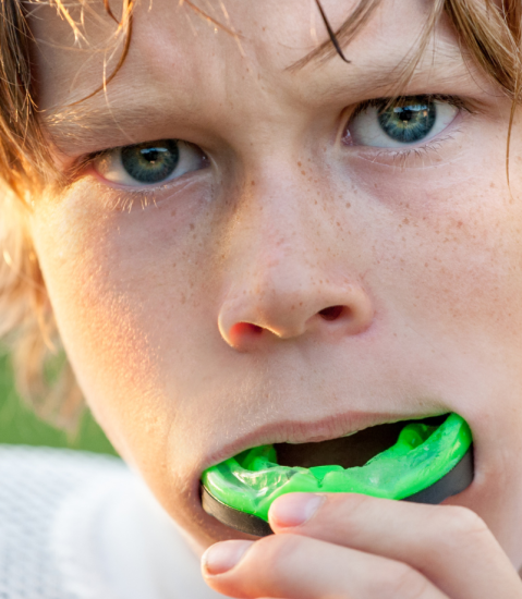 Mouth Guards