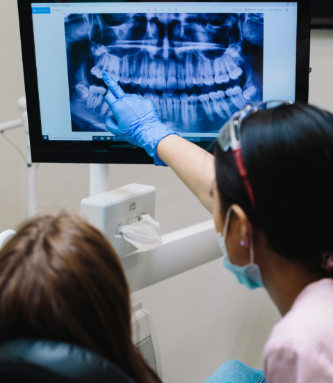 Benefits of digital X-rays and Bridges