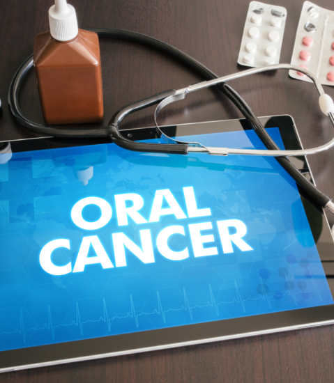Oral Cancer Screening