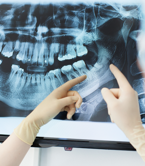 Understanding digital X-rays